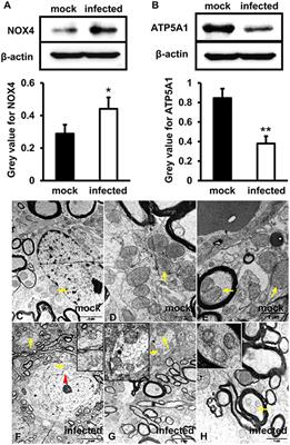 Hepatitis E Virus Induces Brain Injury Probably Associated With Mitochondrial Apoptosis